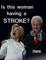 A stroke occurs when the blood supply to an area of the brain is cut off.